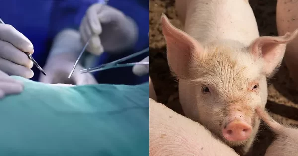 Scientists at Yale Revive Dead Pig’s Organs Within an Hour of Death