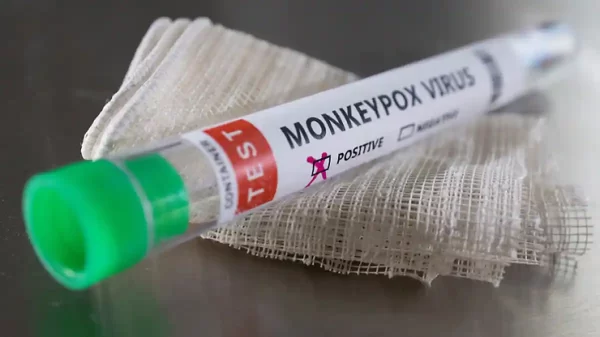 Spain reports second death from monkeypox