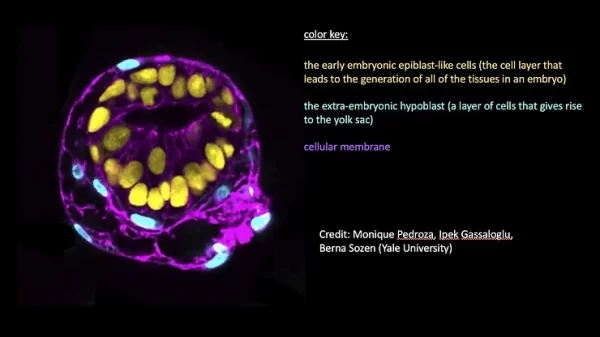 What Human Embryo Models Could Bring to The Table