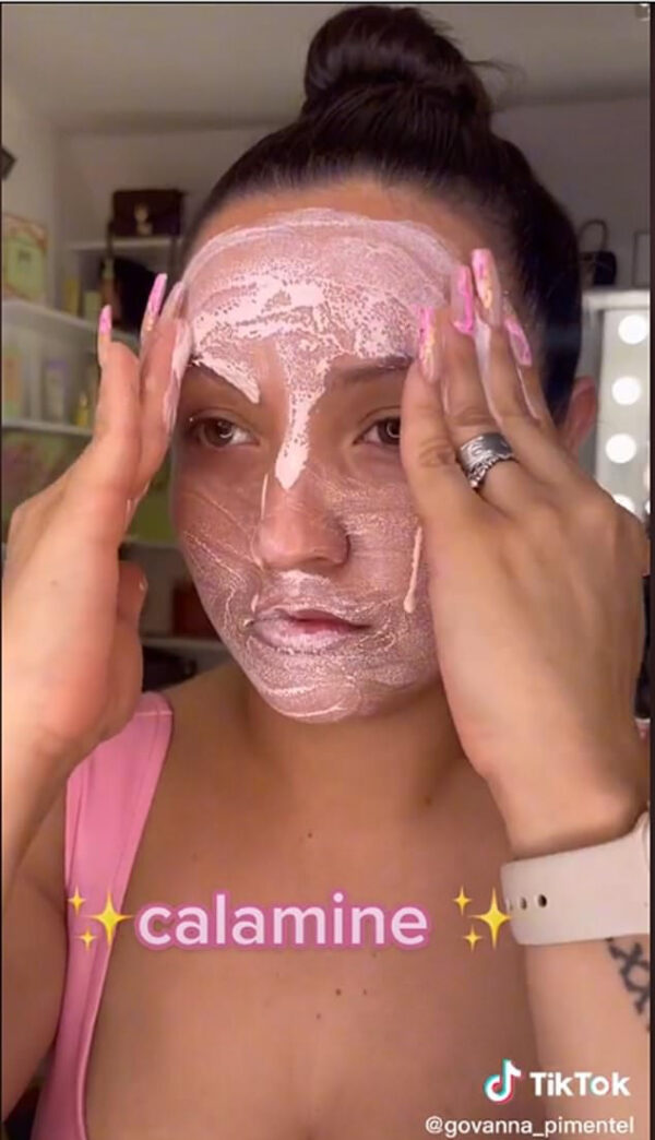 TikTok’s New Harmful and Damaging Beauty Trend Is Calamine Lotion