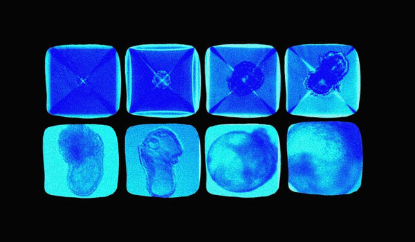 Synthetic mouse embryos might be a potential strategy to heal humans