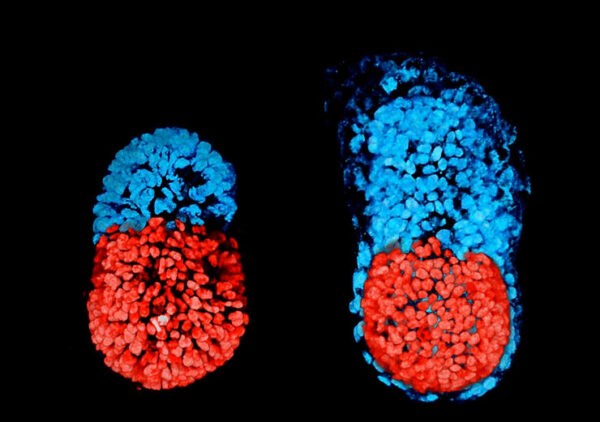 Scientists Make Synthetic Mouse Embryos Which Could be a Powerful Tool in Healing Humans.