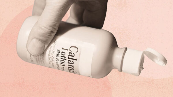 Calamine Lotion: Too Good to be True?