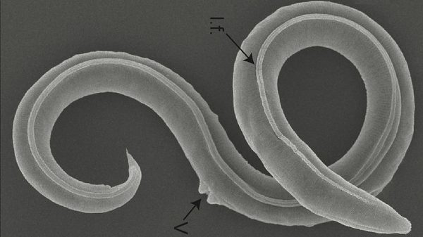 Frozen Worms Still Alive After 46,000 Years