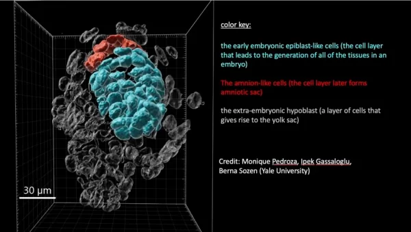 Scientists use Stem Cells to Study Human Birth