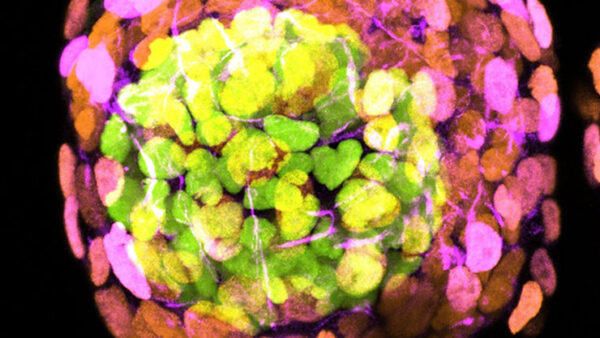 Scientists Make Human Embryo Models